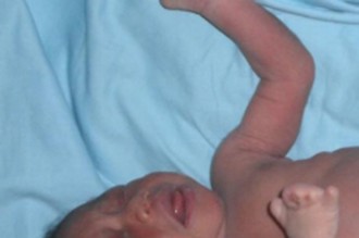 Côte d'Ivoire : Une mère brûle son bébé avec des produits eclaircissants